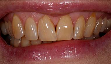 Before - Altondental Dental